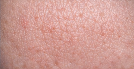 Dermatitis example