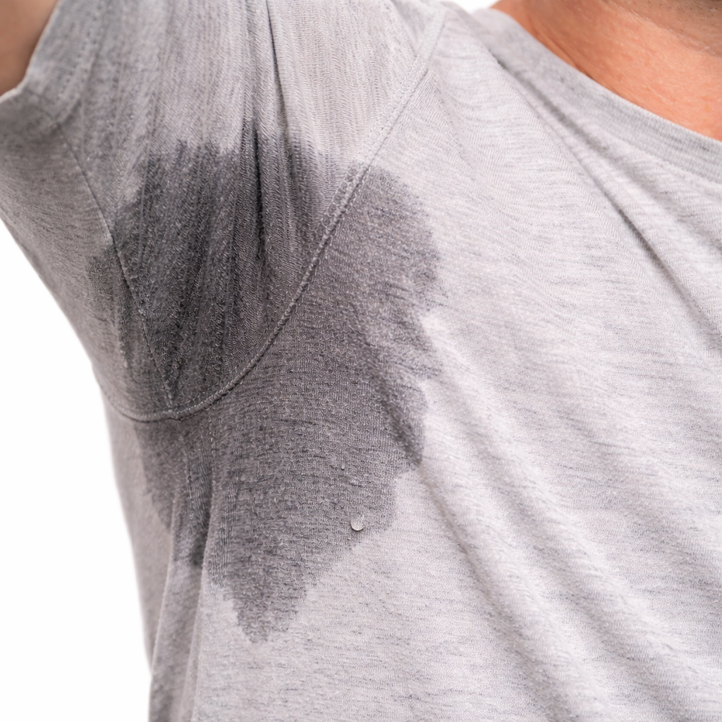 Excessive Sweating example